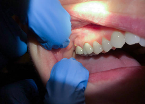 Best Emergency Gum Pain Relief  in Swannanoa, NC